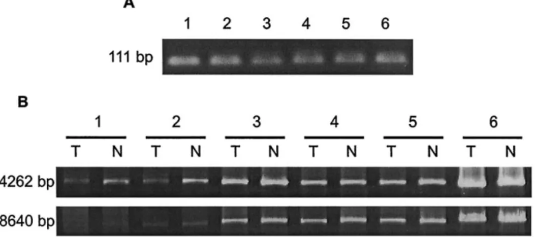 Fig. 4. Gel electrophorectogram of polymerase chain reaction (PCR) products amplified from mitochondrial DNA (mtDNA) of atrial muscles of atrial fibrillation (AF) and non-AF patients by using the primer pairs (A) L3/H1 (111 bp) and (B) L8/H6 (4262 bp), and