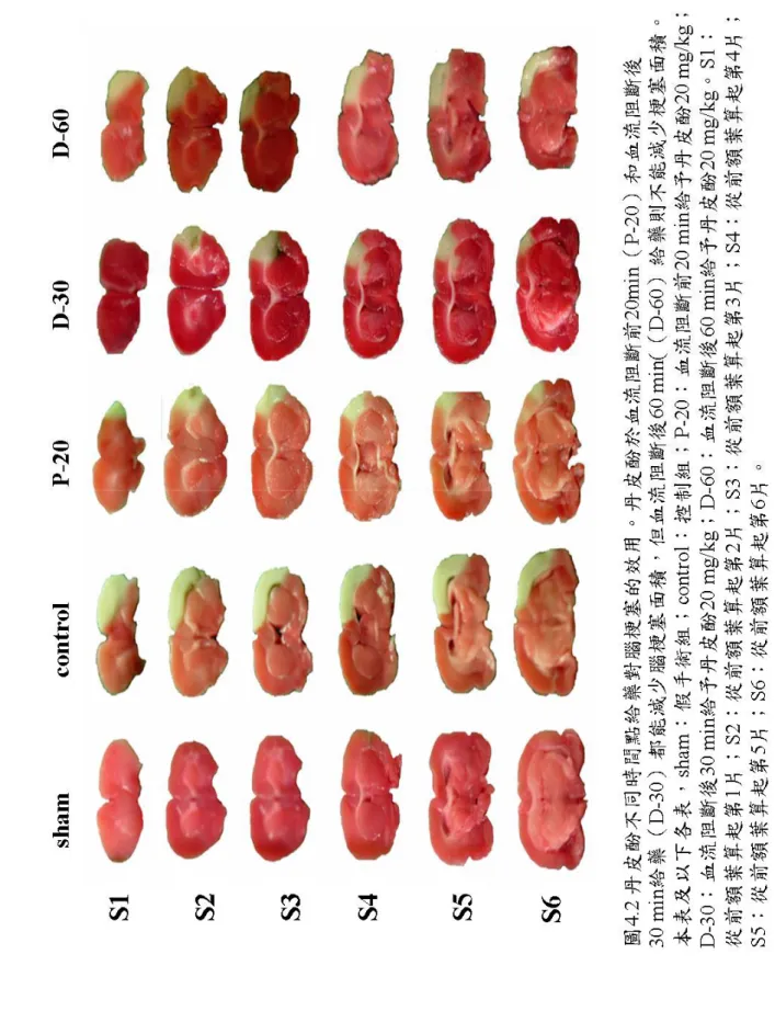 圖 4.2  丹皮酚不同時間點給藥對腦梗塞的效用。