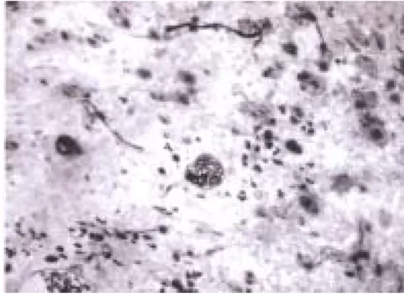 Figure 3: Light micrograph of a  representative cross section of regenerated  nerve specimen 