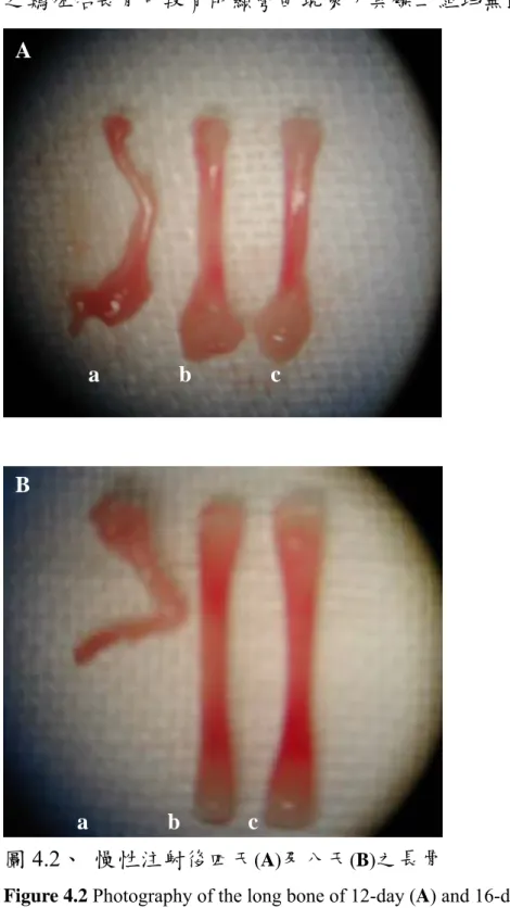 Figure 4.2 Photography of the long bone of 12-day (A) and 16-day (B) embryos 