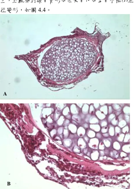 Figure 4.4 Histological observations of long bone of chick embryo treated with  aluminum citrate for 4 days