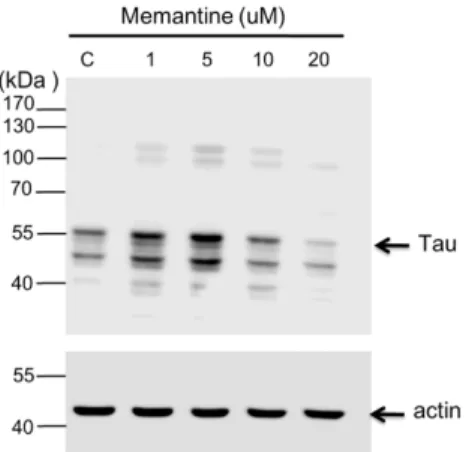 Fig   4.  Western   blot   analysis   showing   the   effect   of   memantine   on   tau   protein expression in the N2A cell lysate