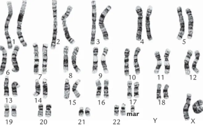 Figure 1. The G-banded karyotype. mar=marker chromosome.