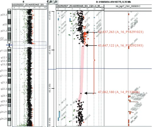 Figure 5. Oligonucleotide-based array comparative genomic hybridization (aCGH) demonstrates a 4.4 Mb duplication in 8p11.21  q11.1 [arr cgh 8p11.21q11.1 (42,637,263-47,062,180) ×3]