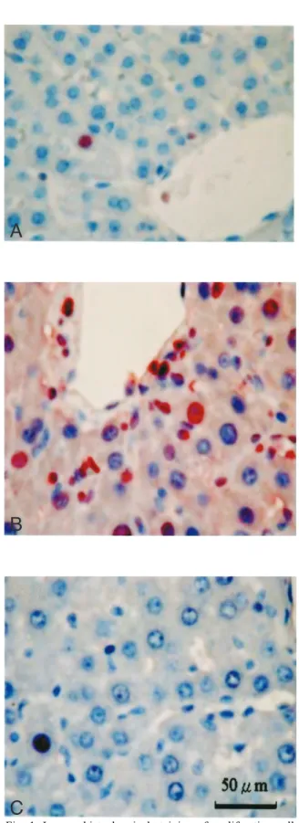 Fig.  1.  Immunohistochemical  staining  of  proliferating  cell nuclear  antigen  (PCNA)  in  hepatocytes  in  bile  duct-ligated rats