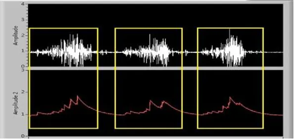 Figure 4. Display of the received EMG signal. The (a) isotonic contraction signal and (b) corresponding waveform envelop is significant.
