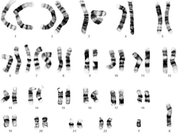 Fig. 1. A karyotype of 47,XY, þ7.