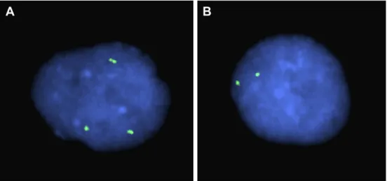 Fig. 4. Interphase fluorescence in situ hybridization (FISH) analysis on uncultured amniocytes using a bacterial artificial chromosome probe RP11-432A1 (7q11.1;
