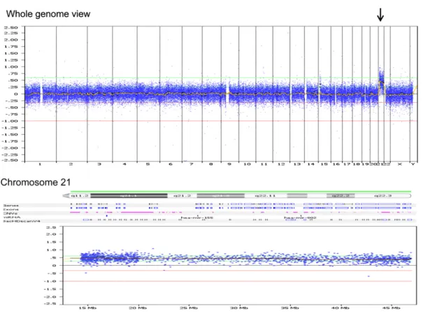 Fig. 4. Conventional cytogenetic analysis using cultured amniocytes shows a karyotype of 47,XY, þ21.