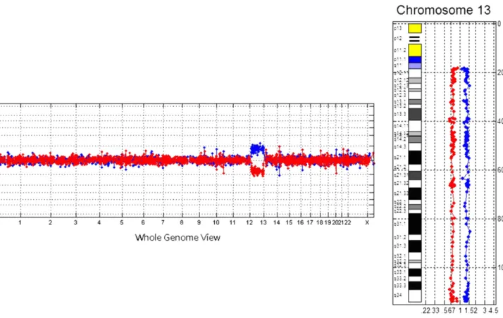 Fig. 11. Bacterial artificial chromosome-based array comparative genomic hybridization in Case 5 shows a duplication of chromosome 13 consistent with the diagnosis of trisomy 13.