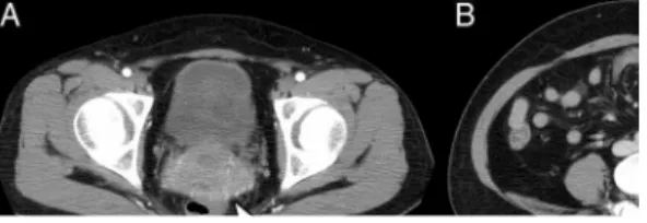 FIGURE 2. Subsequently, contrast-enhanced computed tomography (CT) of the 