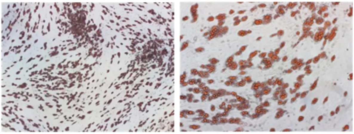 Figure 2. Human SGBS preadipocytes differentiated into mature SGBS adipocytes. 