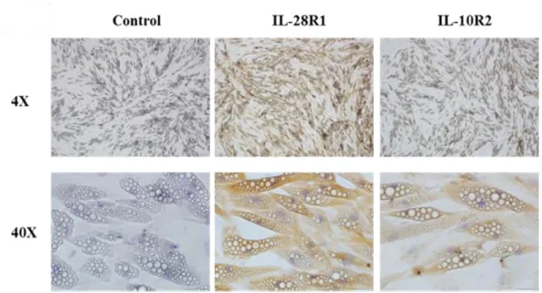Figure 3. Expression of IL-29 receptors IL-28R1 and IL-10R2 in human SGBS  adipocytes by immunohistochemistry staining