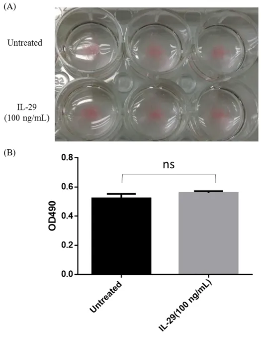 Figure 5. IL-29 did not regulate lipid content of SGBS adipocytes.   