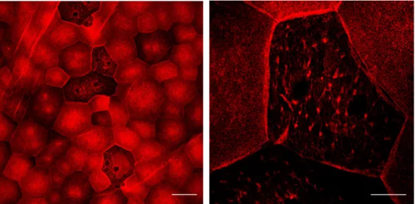 Fig. 8. Aggregation of keratin on umbrella cells of urinary bladder. A. The mouse  bladder was blocked with anti-Keratin 8 and examined under confocal microscope