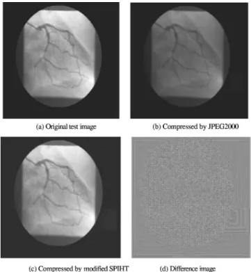 Fig. 9 (a) Sonogram test image; (b) compressed by JPEG2000 with a bit rate ⫽ 1.4 bpp and PSNR value ⫽ 40.6 dB; (c) compressed by modified SPIHT with a bit rate ⫽ 1.4 bpp and PSNR value ⫽ 43.3 dB;