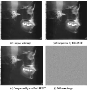 Fig. 10 (a) X-ray test image; (b) compressed by JPEG2000 with a bit rate ⫽ 0.8 bpp and PSNR value ⫽ 41.9 dB; (c) compressed by modified SPIHT with a bit rate ⫽ 0.8 bpp, PSNR value ⫽ 43.6 dB; and (d) difference image.
