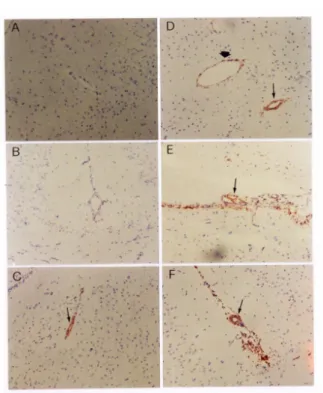 Figur e  2.  Development  of  meningitis  in cefazolin-tr eated  miceafter   injection  with S.pneumoniae type 6.