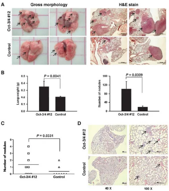 FIGURE 2. Overexpression of Oct-3/4 promotes metastasis in animal models of experimental  pulmonary and spontaneous metastases