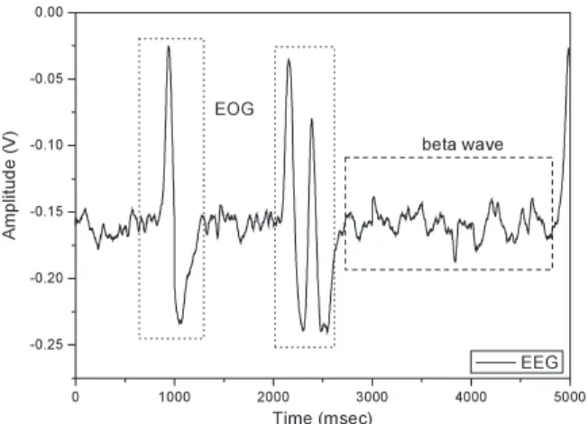 Fig. 14 The EOG signal acquired by the proposed sigma-delta modulator and software digital filter.