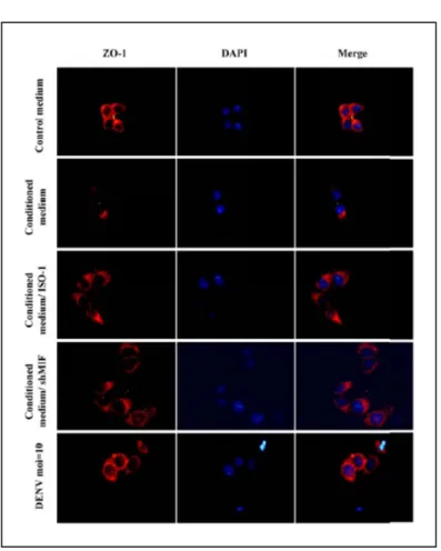 Figure 6. The effect of condition medium and rMIF on ZO-1 expression.   