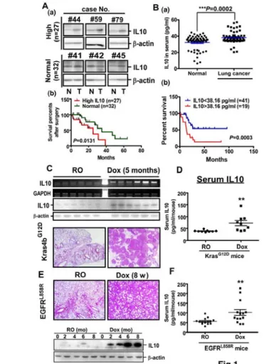 Figure 1. IL10 is over expressed in lung cancer. A. Upper panel: the representative image of IL10  expression from 6 independent groups