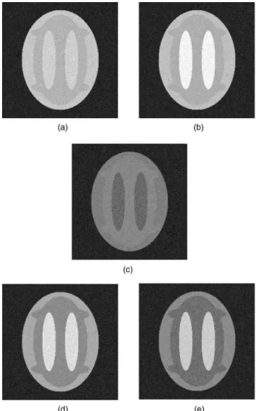 Fig. 9 Test phantoms for simulating different objects (BKG, GM, WM, and CSF) in meltispectral image.