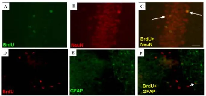 Figure 7. The neuronal identity of bromodeoxyuridine (BrdU)(+) cells in the hippocampal dentate  gyrus after hypoxic-ischemia (HI)