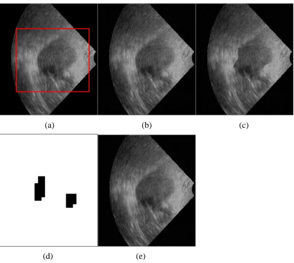 FIGURE  7. (a)  Original image with the  ROI selection,  (b)  watermarked image,  (c)  tampered image, (d) tamper detection result, (e) recovered image