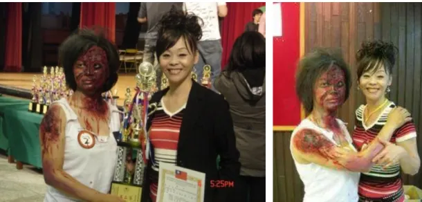 圖 4-3.3  皮綻肉開傷之特效技法(三)    圖 4-3.4 皮綻肉開傷之特效技法(四)    2011，張雪雁拍攝         做完基礎保養後開始設計主題的特效化法，利用衛生紙及皮膚蠟函上乳膠、黃膠結合 化出栩栩如生的皮綻肉開的逼真感。      再同時設計一道深溝的皮綻撕裂感使特效呈現更真實的可怕效果讓影視特效之視覺 達到創意及感官的最佳程度。       1、用萬能刀將膚蠟從盒子中摳出來適量，用手稍捏軟；       2、軟硬度適中的時候，改用萬能刀將膚蠟抹在皮膚上，圕成疤痕形狀；     
