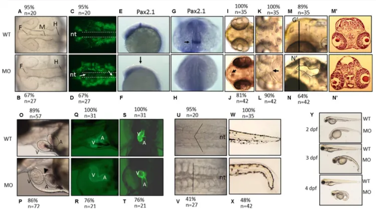 FIGURE 5 | The morphological characteristics of zPnpo morphants. Zebrafish embryos of wild-type and transgenic lines injected with zPnpo MO at one- to two-cell  stages were grown in embryo water and recorded for embryonic organogenesis and development