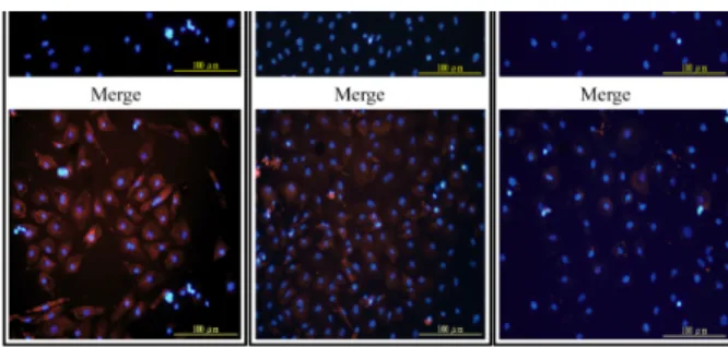 Fig. 1. Immunological subcellular  localization of grouper Mx proteins in  nodavirus infected or poly[I:C] induced Mx  expressing grouper cells