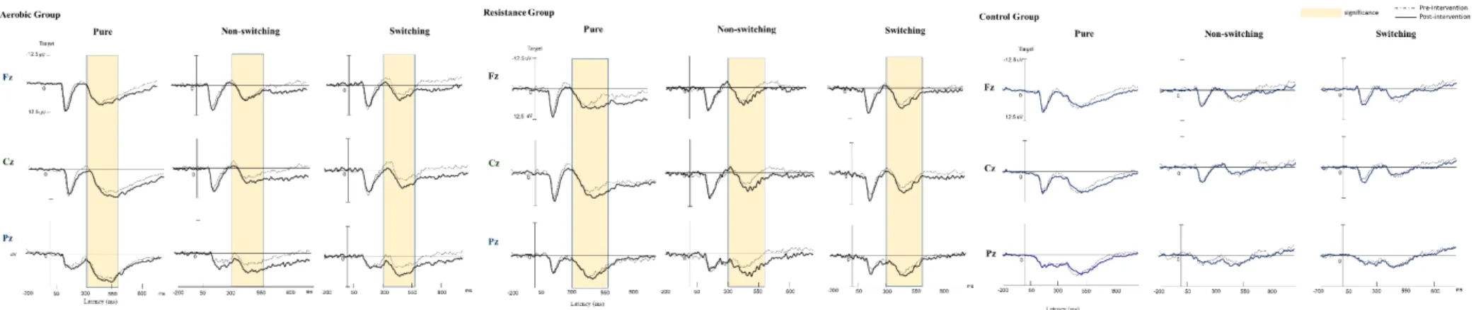 Figure 3. Grand average event-related potential waveforms of three electrodes (Fz, Cz, &amp; Pz) for three conditions (homogeneous, non-