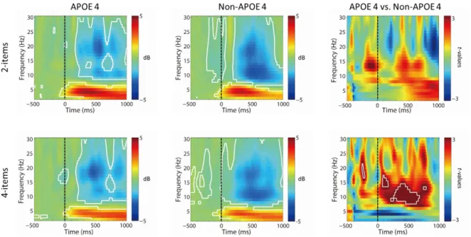 Figure 2. Time-frequency decomposition with Morlet wavelets in the frontal region (Fz)