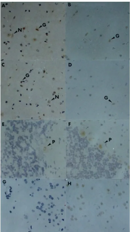 Fig.  4. Immunocytochemical  analysis  of  the  TNF-α  expression  in  the  B6 