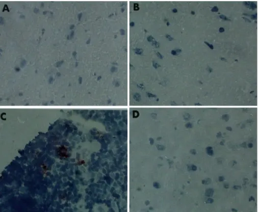 Fig. 5.TUNEL analysis of apoptosis in the B6 mouse brain. LPS: A (cerebral  cortex), Pb: B (cerebral  cortex), Mock  control: C (thymus), Mock  control: D  (cerebral cortex)