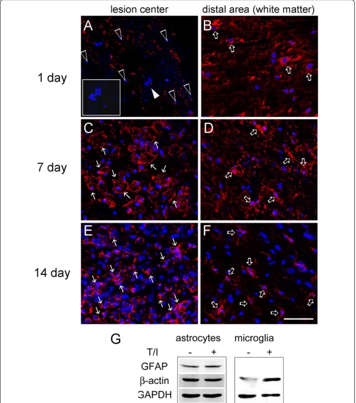Figure 4 Immunofluorescence for b-actin expression in injured spinal cord tissue sections