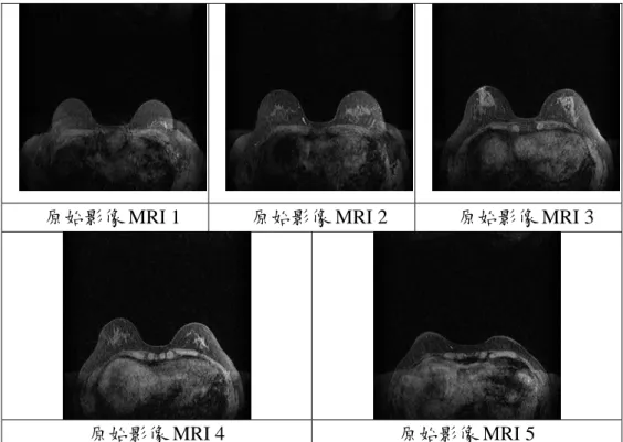 圖 1-7. 實驗使用的 5 張原始胸部 MRI 影像 