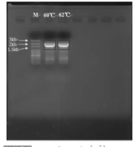 圖 5.  淡水綠藻 Desmodesmus AELCNU-013 的 18S  rDNA 的 PCR 產物電泳圖。