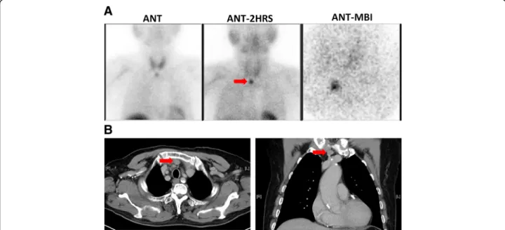 Fig. 1 a Parathyroid scan with Tc-99 m MIBI, (b) Post contrast chest and mediastinal CT scan