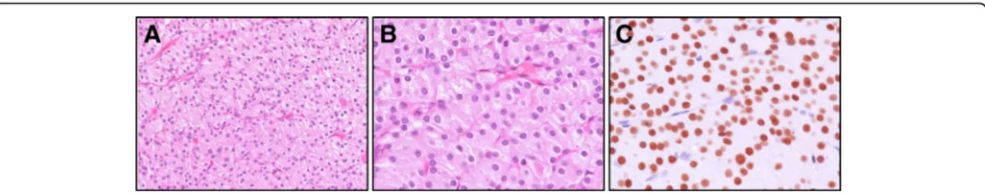 Fig. 2 a The histopathological examination showed lobules of hyperplastic parathyroid tissues composed primarily of chief cells with thin delicate vascularity, nuclear monomorphism, central round nuclei and granular cytoplasm (200X, H &amp;E stain), (b) 40