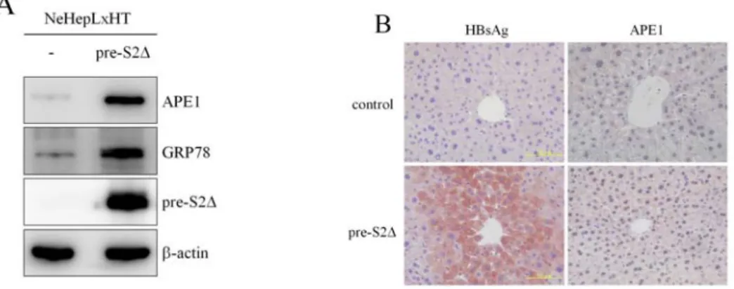 Figure 5. HBV pre-S2誘導內質網壓力及 APE1 表現。(A)以 pre-S2D 蛋白質在 NeHepLxHT 細 胞表現，之後分析以 western blotting 分析 APE1 及 GRP78 的表現。(B)  利用 Immunohistochemistry 分析 pre-S2轉殖鼠的 APE1 表現情形。 