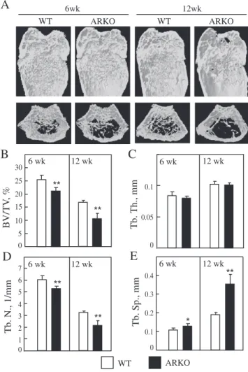 Fig. 1. Micro-CT images and computer-aided analysis of the trabecular femoral bones of 6 and 12 week-old mice