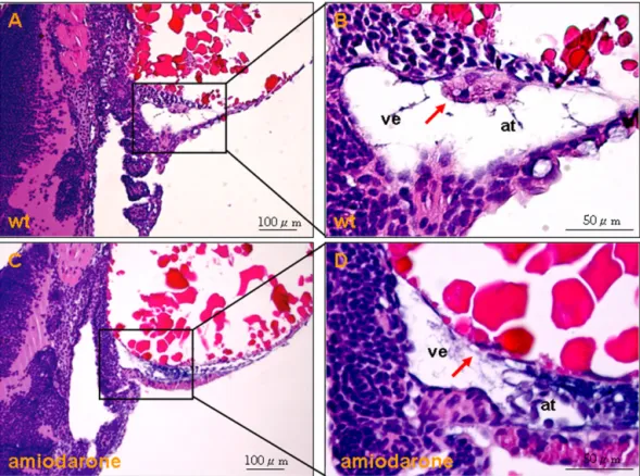 Fig. 2. Amiodarone caused developmental abnormality of cardiac valves in zebraﬁsh embryos