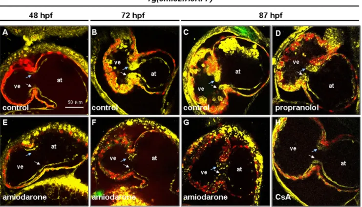 Fig. 3. In vivo observation of the cardiac valve defects in the Amiodarone-treated zebraﬁsh embryos