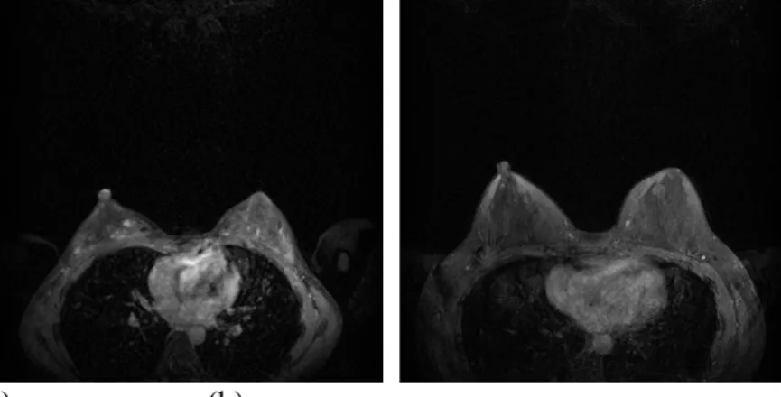 Fig. 1. Examples of MRI slices for two cases: (a) Slice 53 of case 1; (b) Slice 74 of case 2