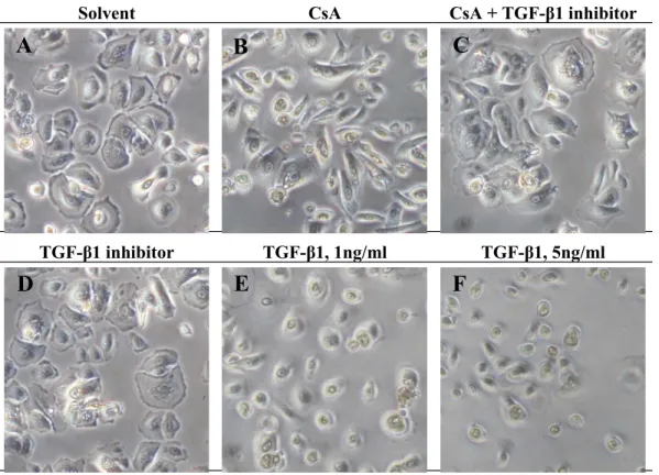 Figure 5. Effect of TGF-β1 inhibitor on the cell morphology in hGE cells received CsA treatment