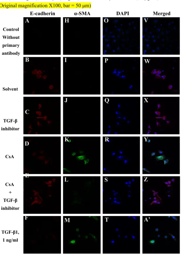 Figure 6. Effect of TGF-β1 inhibitor on the protein expression of EMT markers in hGE   cells  received   CsA   treatment
