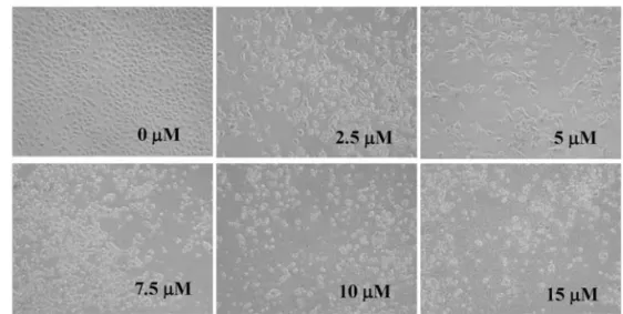 Figure 1. BITC induces cell morphological changes and decreases the viability in DU 145 cells