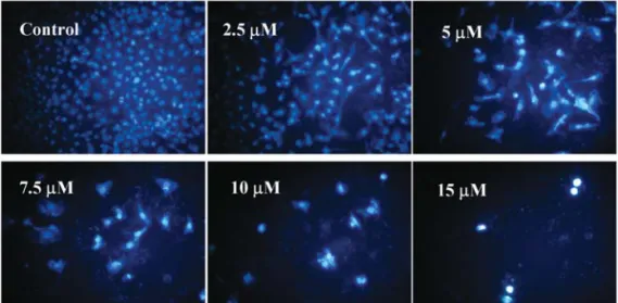 Figure 3. BITC induces apoptosis and DNA damage in DU 145 cells. Cells were treated with BITC at various doses and were then incubated for 24 h
